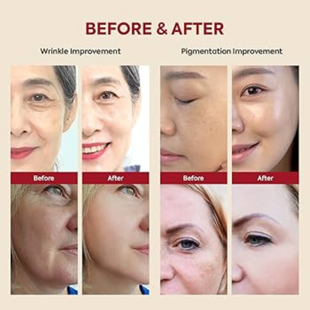 Seoul 1988 Retinal Cream - Remove Fine lines + Wrinkle & Give Clean, Tight & Glowy Skin