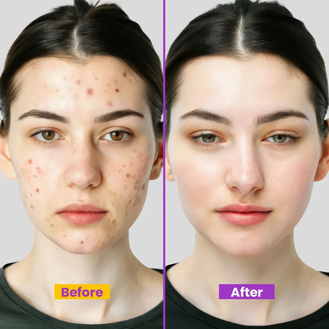 Dubai Magical Cream | Korean Glass Skin Instant Glow Formula with Vitamin C, Niacinamide & Vitamin E | Fades Dark Spots, Acne Scars & Uneven Tone