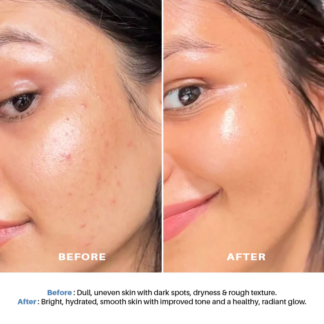 L'Oréal Paris Glycolic Bright Niacinamide Exfoliant Peel | Reduces Pigmentation, Dark Spots & Evens Skin Texture