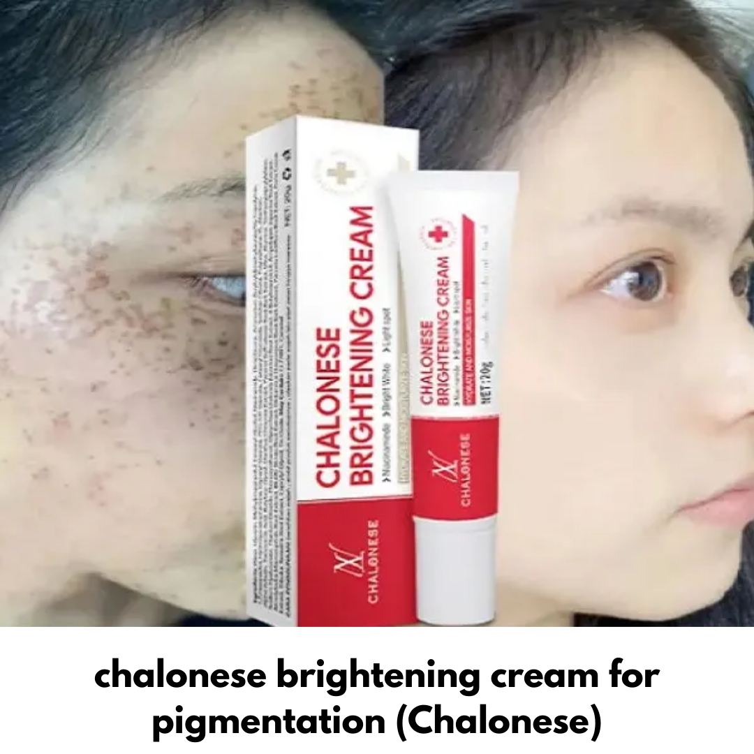 Chalonese Brightening Cream | Fade Pigmentation, Dark Spots & Acne Marks with Niacinamide + Alpha Arbutin