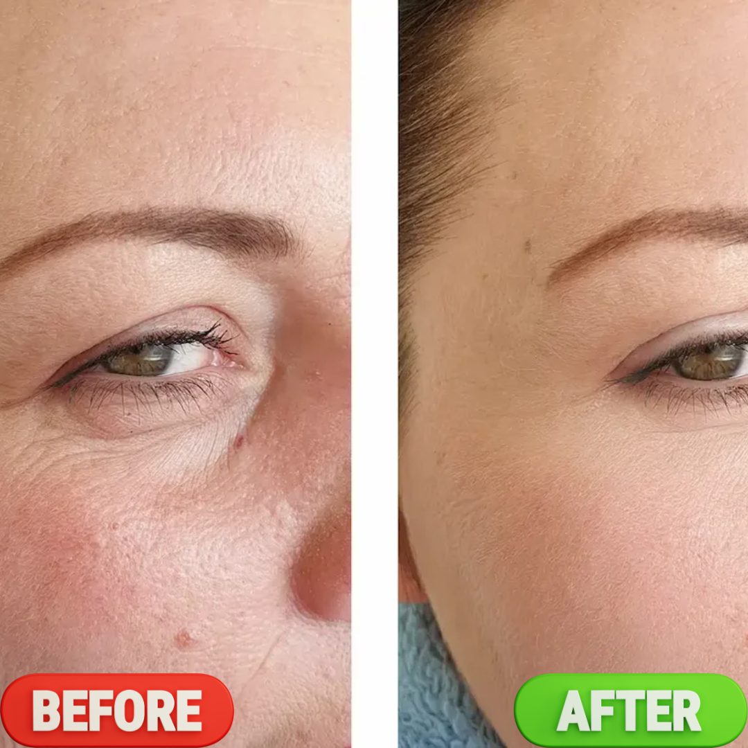 numbuzin NAD+ Retinol Volumetox Eye Cream – Lift, Brighten & Revive – Visible Eye Renewal – Reduces Dark Circles, Crow's Feet, Eye Bags & Fine Lines