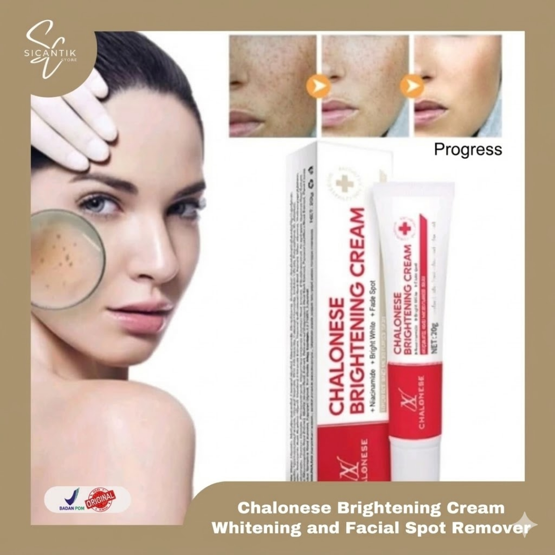 Chalonese Brightening Cream | Fade Pigmentation, Dark Spots & Acne Marks with Niacinamide + Alpha Arbutin