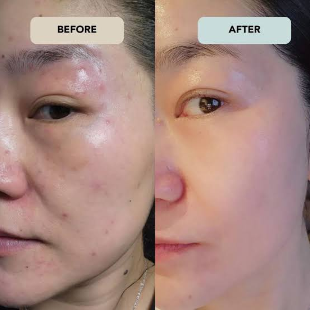 Amor Insta Glow – 5-Minute Glow Transformation – Remove Tan, Bright & Smooth Skin – Korean Glass Skin Formula – Instantly Reveals Radiant, Dewy Skin