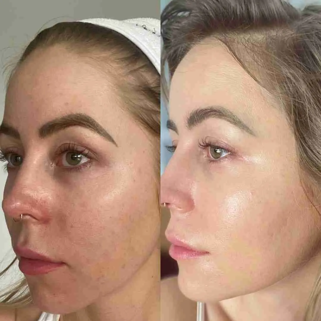 Dubai Magical Cream | Korean Glass Skin Instant Glow Formula with Vitamin C, Niacinamide & Vitamin E | Fades Dark Spots, Acne Scars & Uneven Tone