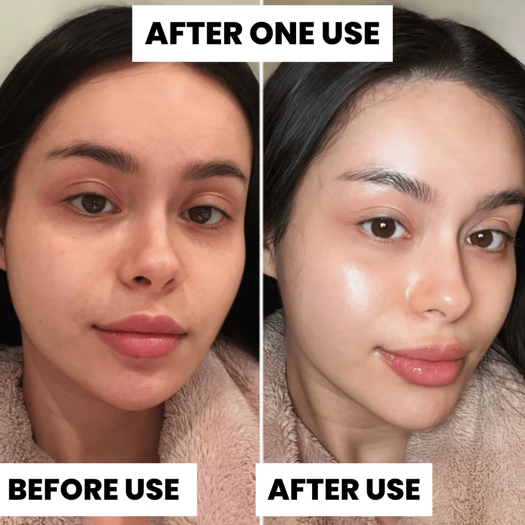 L'Oréal Paris Glycolic Bright Niacinamide Exfoliant Peel | Reduces Pigmentation, Dark Spots & Evens Skin Texture