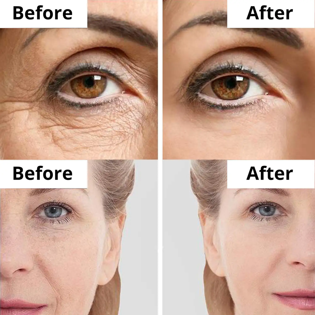 numbuzin NAD+ Retinol Volumetox Eye Cream – Lift, Brighten & Revive – Visible Eye Renewal – Reduces Dark Circles, Crow's Feet, Eye Bags & Fine Lines