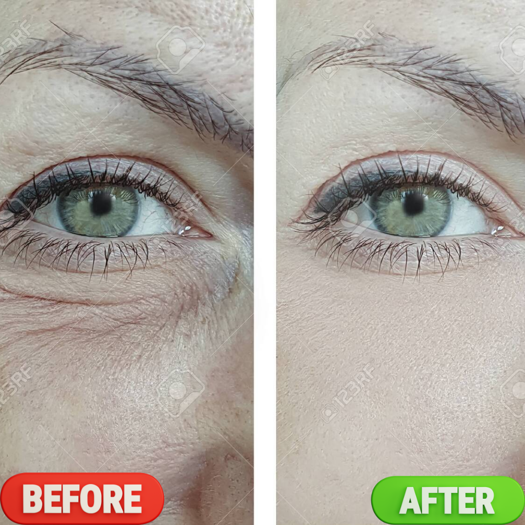 numbuzin NAD+ Retinol Volumetox Eye Cream – Lift, Brighten & Revive – Visible Eye Renewal – Reduces Dark Circles, Crow's Feet, Eye Bags & Fine Lines