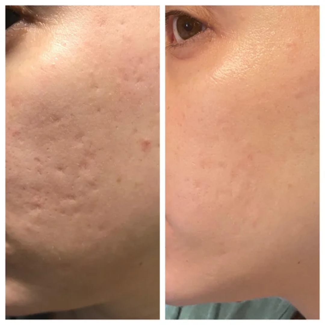 Dubai Magical Cream | Korean Glass Skin Instant Glow Formula with Vitamin C, Niacinamide & Vitamin E | Fades Dark Spots, Acne Scars & Uneven Tone