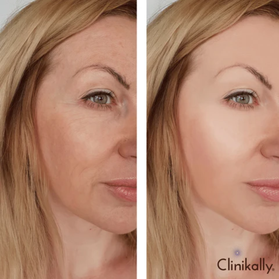 Foxtale Fluid Sunscreen with Niacinamide & Tinted Fluid Sunscreen Duo | SPF 50, Oil Control, Pore Blurring & Skin Brightening for All Skin Types