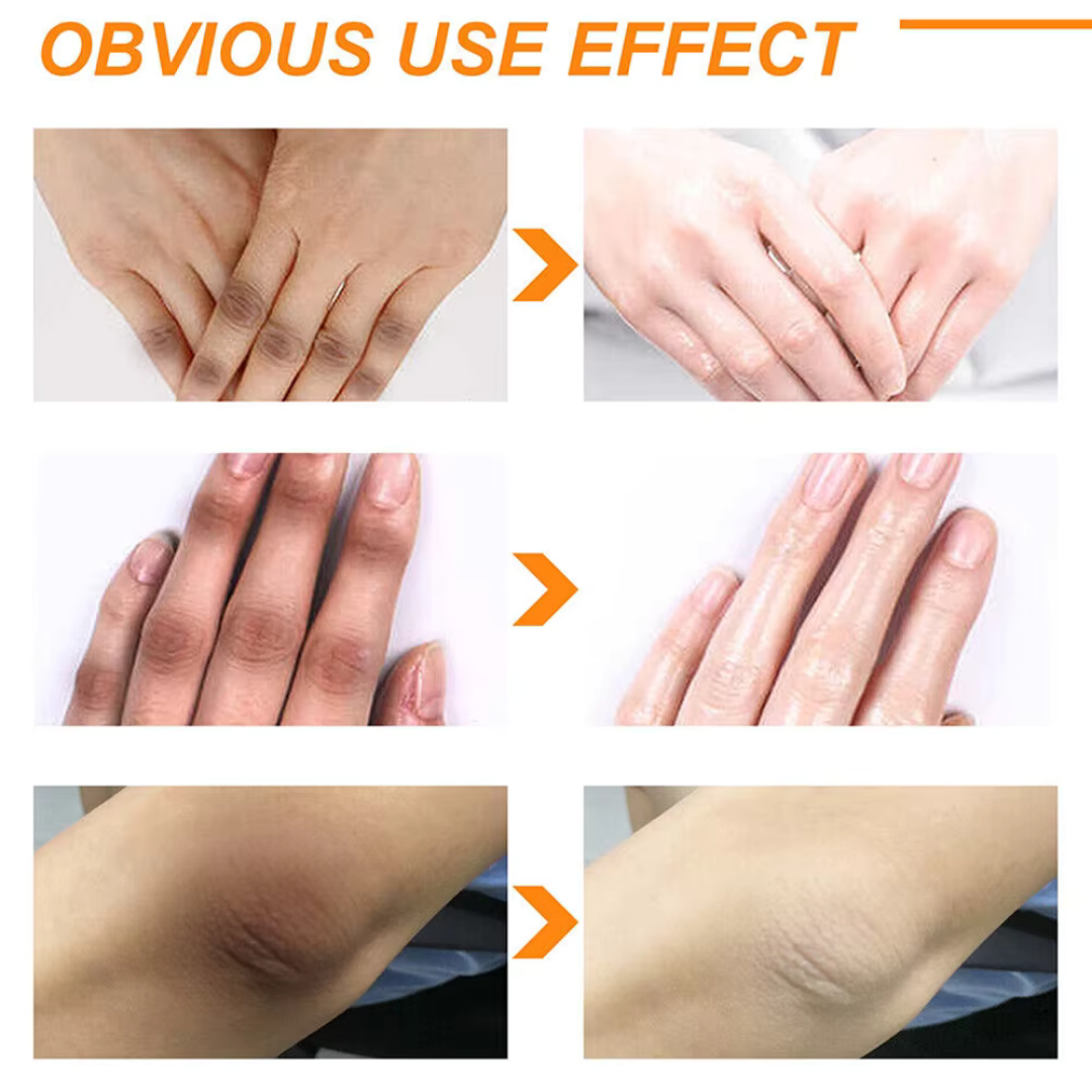 Chalonese Brightening Cream | Fade Pigmentation, Dark Spots & Acne Marks with Niacinamide + Alpha Arbutin