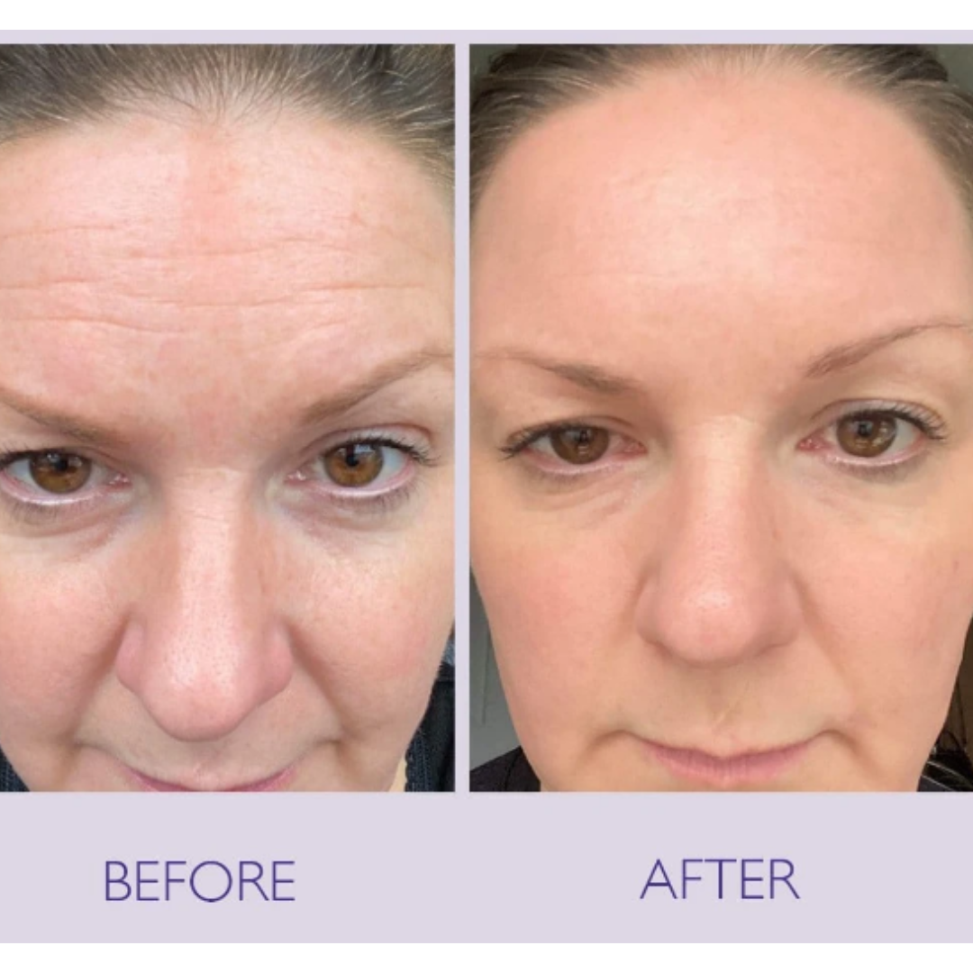 Celimax Retinal Skin Tightening Booster Cream (Tighten, Tone up & Instant brighten Skin - Guaranteed results)