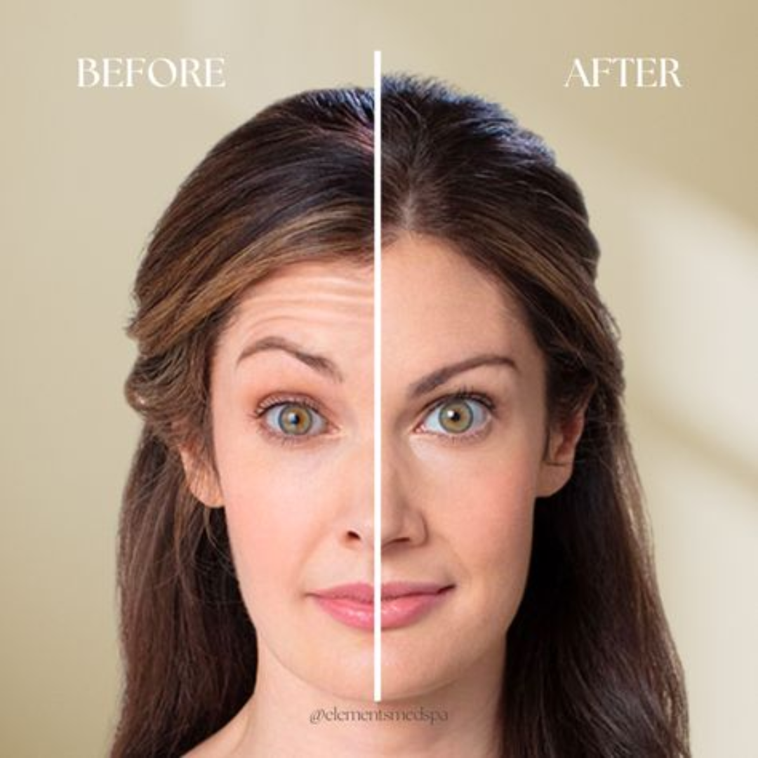 Celimax Retinal Skin Tightening Booster Cream (Tighten, Tone up & Instant brighten Skin - Guaranteed results)