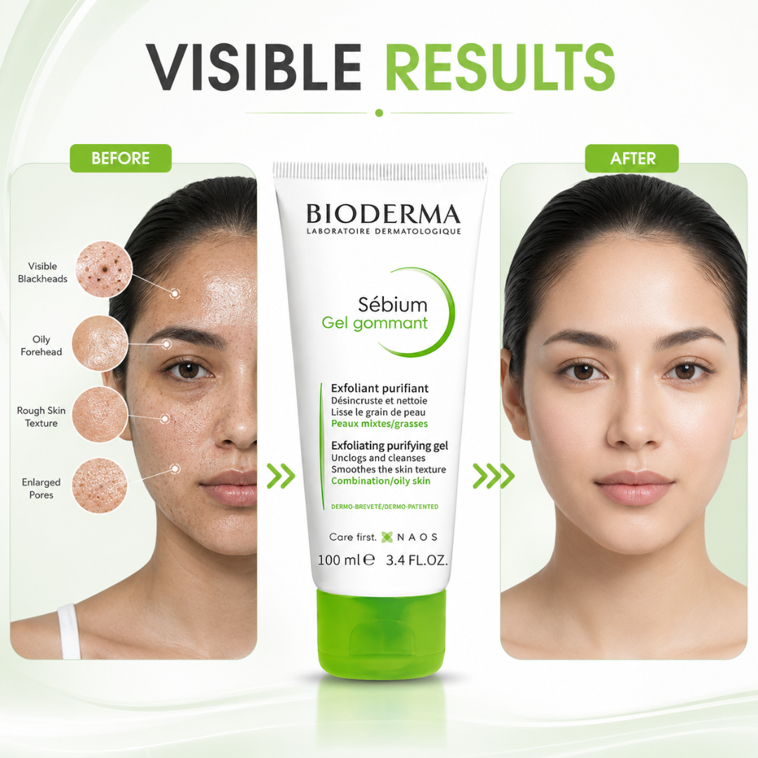 Bioderma Sébium Exfoliating Purifying Gel – Up to 50% OFF – Deep Cleanse, Exfoliate & Purify – Unclogs Pores, Controls Oil, Smooths Skin Texture
