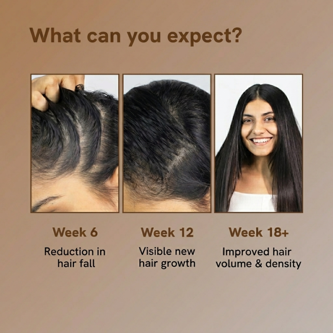 Bare Anatomy Advanced Hair Growth Serum Roll-On | 3% Redensyl + 4% Anagain + 2% Baicapil + 5% Rosemary | Reduces Hair Fall, Activates Growth & Strengthens Roots