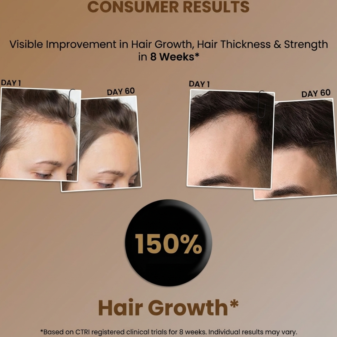 Bare Anatomy Advanced Hair Growth Serum Roll-On | 3% Redensyl + 4% Anagain + 2% Baicapil + 5% Rosemary | Reduces Hair Fall, Activates Growth & Strengthens Roots
