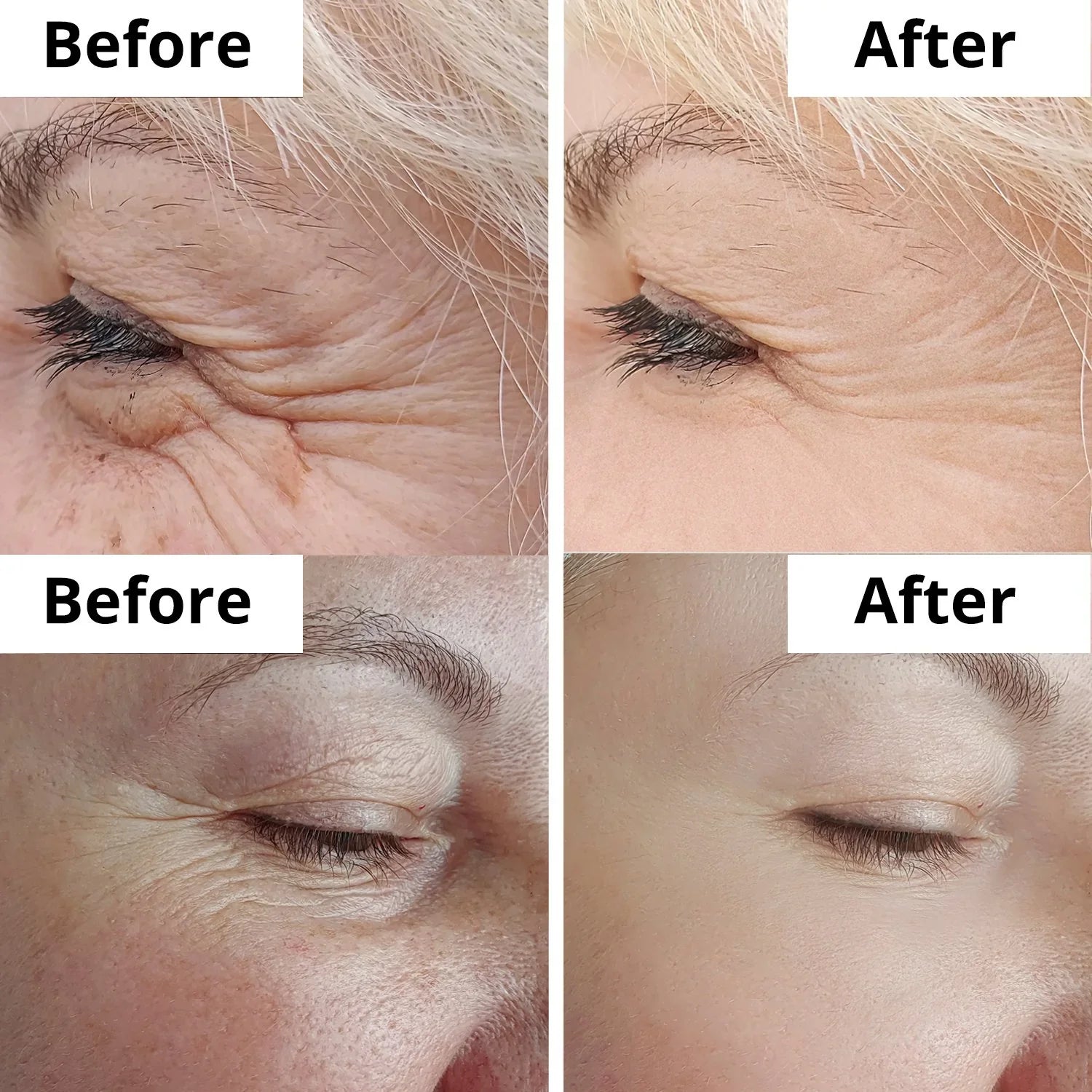 Arencia Vitamin C Cream | Removes Dark Spots & Pigmentation | Reduces Fine Lines & Wrinkles | Anti-Aging & Acne Mark Fading | Deep Hydration & Skin Brightening
